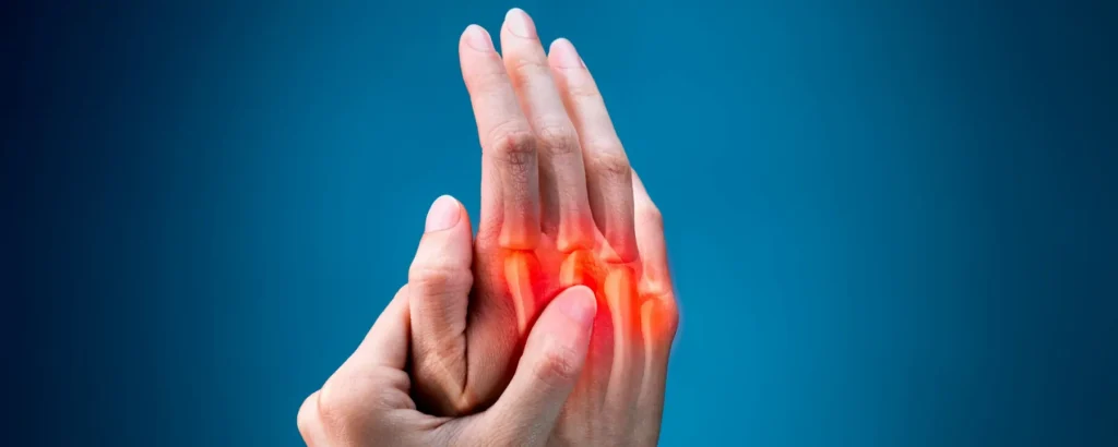 مفاصل دردناک انگشتان دست در روماتیسم مفصلی